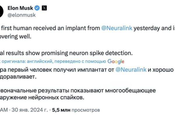 Компания Neuralink впервые провела успешное внедрение импланта в человеческий мозг